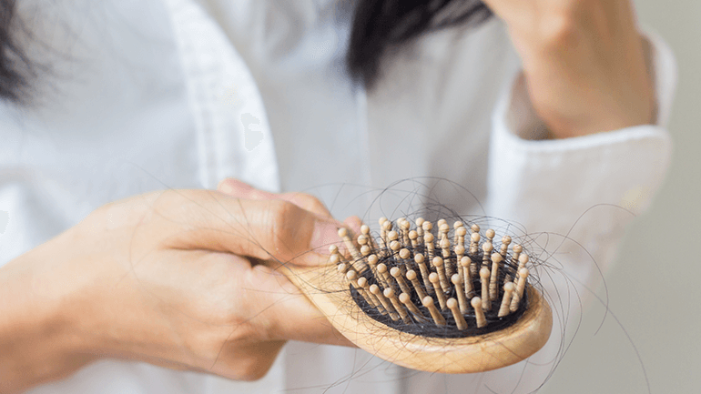 Hair Loss: When Should You Worry? What Are the Solutions?